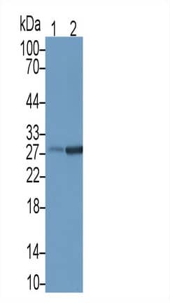 Western Blot: NKG2D/CD314 Antibody (C1) [NBP3-41507] - Sample: Lane1: Rat Pancreas lysate; Lane2: Rat Spleen lysate Primary Ab: 1ug/ml NBP3-41507