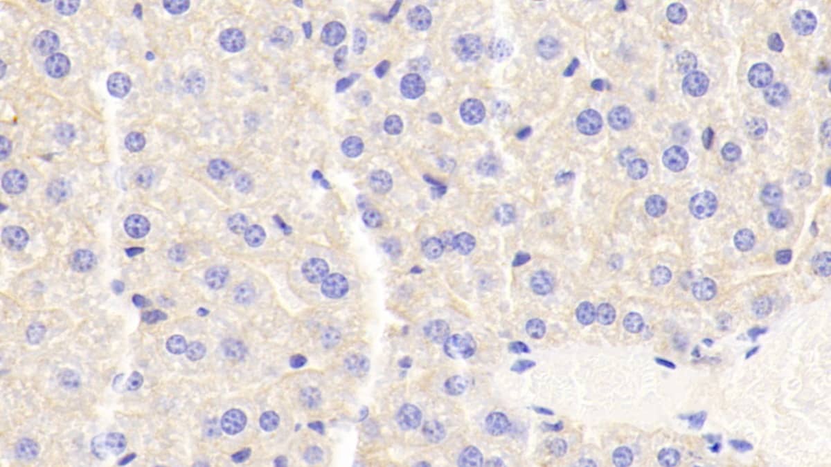 Immunohistochemistry-Paraffin: Apolipoprotein CIII Antibody (D6) [NBP3-41510] - DAB staining on IHC-P; Samples: Mouse Liver Tissue; Primary Ab: 20ug/ml NBP3-41510; Second Ab: 2ug/mL HRP-Linked Caprine Anti-Mouse IgG Polyclonal Antibody