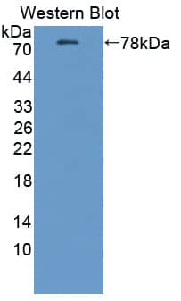 Western Blot PMCA2 Antibody