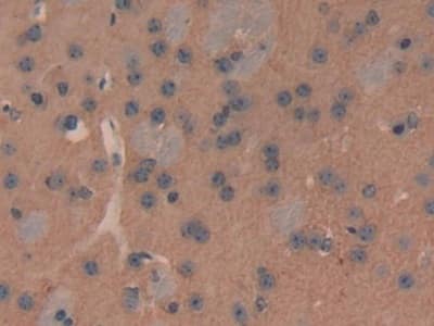 Immunohistochemistry-Paraffin PMCA2 Antibody