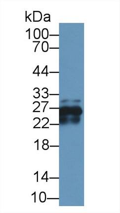 Western Blot CRYBA1 Antibody