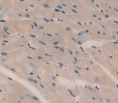 Immunohistochemistry-Paraffin HMCN1 Antibody - BSA Free
