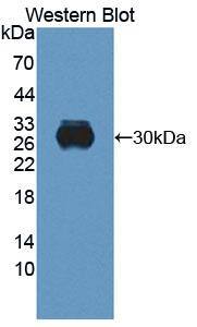 Western Blot RTBDN Antibody - BSA Free