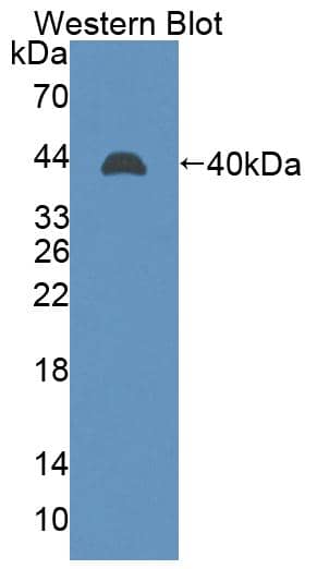 Western Blot LIM2 Antibody