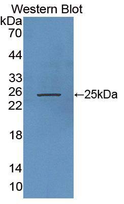 Western Blot: RHAG Antibody [NBP3-41526] - Sample: Recombinant protein.