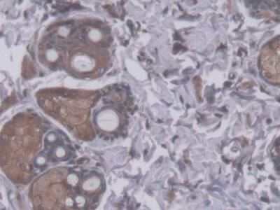 Immunohistochemistry-Paraffin: RHAG Antibody [NBP3-41526] - DAB staining on IHC-P; Samples: Rat Skin Tissue; Primary Ab: 20ug/ml NBP3-41526; Second Ab: 2ug/mL HRP-Linked Caprine Anti-Rabbit IgG Polyclonal Antibody