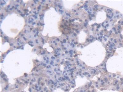 Immunohistochemistry-Paraffin: RHAG Antibody [NBP3-41526] - DAB staining on fromalin fixed paraffin-embedded heart tissue