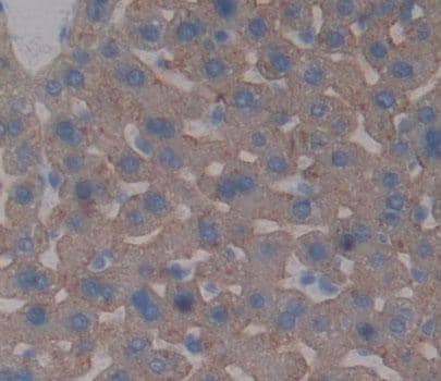 Immunohistochemistry-Paraffin: ABCG5 Antibody [NBP3-41527] - Used in DAB staining on fromalin fixed paraffin- embedded liver tissue