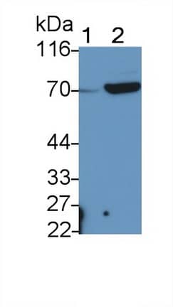 Western Blot ABCG5 Antibody