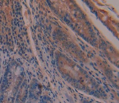 Immunohistochemistry-Paraffin: GBP4 Antibody [NBP3-41528] - Used in DAB staining on fromalin fixed paraffin- embedded intestine tissue
