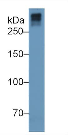 Western Blot: Collagen VII Antibody (C7) [NBP3-41529] - Sample: Human Serum; Primary Ab: 3ug/ml NBP3-41529; Second Ab: 0.2ug/mL HRP-Linked Caprine Anti-Mouse IgG Polyclonal Antibody