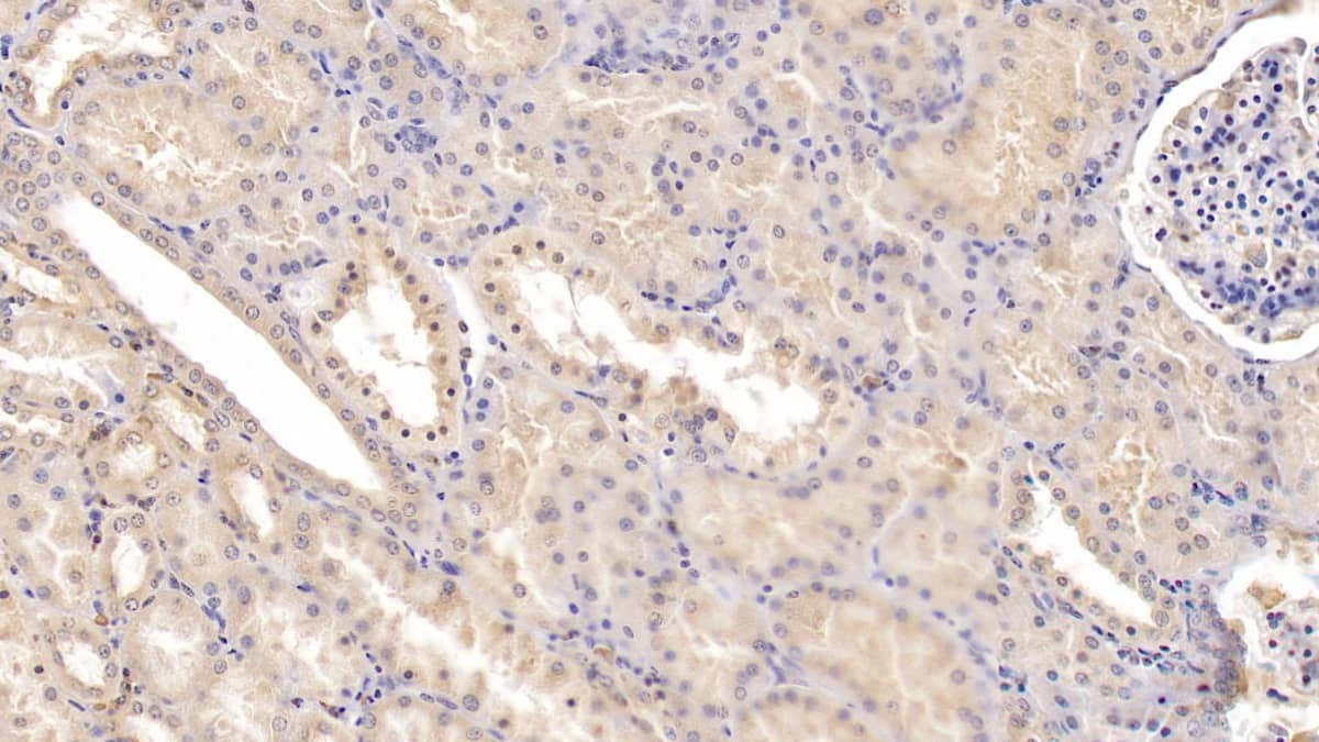 Immunohistochemistry-Paraffin: Tie-1 Antibody (C2) [NBP3-41530] - DAB staining on IHC-P; Samples: Human Kidney Tissue; Primary Ab: 20ug/ml NBP3-41530; Second Ab: 2ug/mL HRP-Linked Caprine Anti-Mouse IgG Polyclonal Antibody