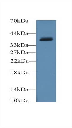 Western Blot: UCP4 Antibody [NBP3-41531] - Sample: Porcine Cerebrum lysate; Primary Ab: 1ug/ml NBP3-41531; Second Ab: 0.2ug/mL HRP-Linked Caprine Anti-Rabbit IgG Polyclonal Antibody