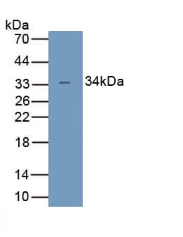 Western Blot: UCP4 Antibody [NBP3-41531] - Sample: Recombinant UCP4, Human.