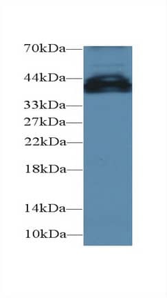 Western Blot: UCP4 Antibody [NBP3-41531] - Sample: Mouse Cerebrum lysate; Primary Ab: 1ug/ml NBP3-41531; Second Ab: 0.2ug/mL HRP-Linked Caprine Anti-Rabbit IgG Polyclonal Antibody