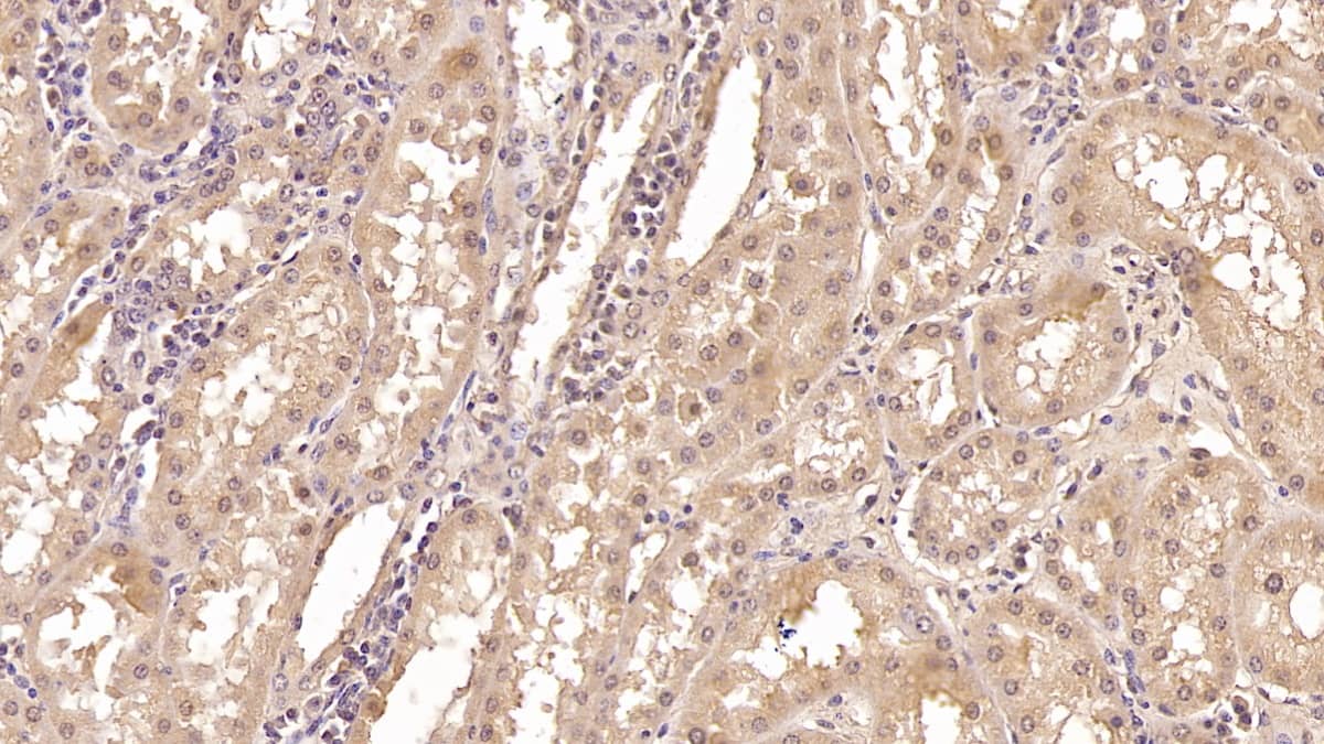 Immunohistochemistry-Paraffin: CRYL1 Antibody (C5) [NBP3-41533] - DAB staining on IHC-P; Samples: Human Kidney Tissue; Primary Ab: 30ug/ml NBP3-41533; Second Ab: 2ug/mL HRP-Linked Caprine Anti-Mouse IgG Polyclonal Antibody