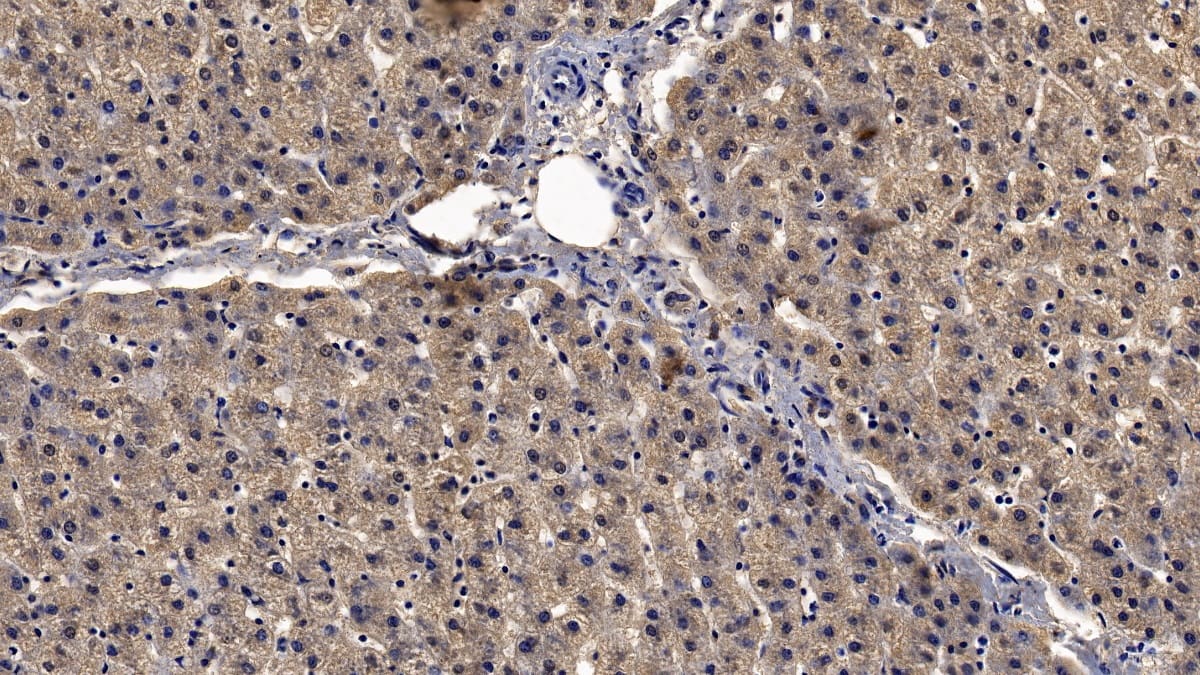 Immunohistochemistry-Paraffin: FGF-9 Antibody (E14) [NBP3-41537] - DAB staining on IHC-P; Sample: Human Kidney Tissue; Primary Ab: 20ug/ml NBP3-41537; Second Ab: 2ug/mL HRP-Linked Caprine Anti-Mouse IgG Polyclonal Antibody