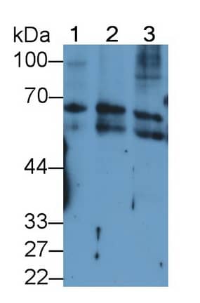 Western Blot: Cytokeratin 2 Antibody (D2) [NBP3-41538] - Sample: Lane1: Rat Liver lysate; Lane2: A431 cell lysate; Lane3: Jurkat cell lysate Primary Ab: 2ug/ml NBP3-41538; Second Ab: 0.2ug/mL HRP-Linked Caprine Anti-Mouse IgG Polyclonal Antibody