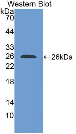 Western Blot: SLC30A6 Antibody [NBP3-41542] - Sample: Recombinant protein.