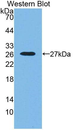 Western Blot SNX18 Antibody