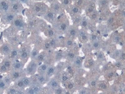 Immunohistochemistry-Paraffin: SNX18 Antibody [NBP3-41544] - DAB staining on IHC-P;  Samples: Mouse Liver Tissue; Primary Ab: 10ug/ml NBP3-41544; Second Ab: 2ug/mL HRP-Linked Caprine Anti-Rabbit IgG Polyclonal Antibody;