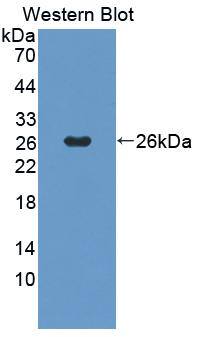 Western Blot: PANK1 Antibody [NBP3-41545] - Sample: Recombinant protein.