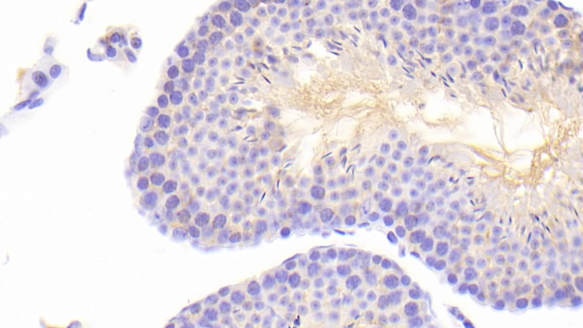 Immunohistochemistry-Paraffin: ABCA6 Antibody [NBP3-41548] - DAB staining on IHC-P; Samples: Mouse Testis Tissue; Primary Ab: 20ug/ml NBP3-41548; Second Ab: 2ug/mL HRP-Linked Caprine Anti-Rabbit IgG Polyclonal Antibody