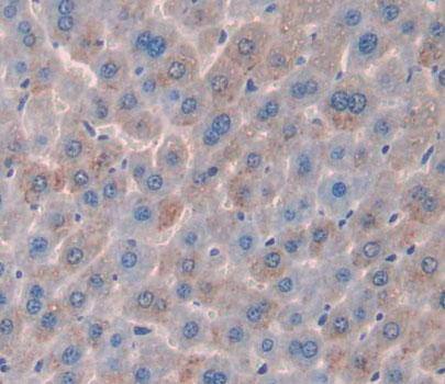 Immunohistochemistry-Paraffin: UPP2 Antibody [NBP3-41549] - Used in DAB staining on fromalin fixed paraffin- embedded liver tissue