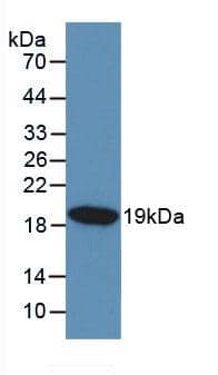 Western Blot: KISS1 Antibody (C1) [NBP3-41551] - Sample: Recombinant KISS1, Human.