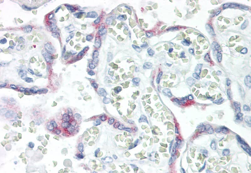 Immunohistochemistry-Paraffin: KISS1 Antibody (C1) [NBP3-41551] - Vector Red staining on IHC-P; Samples: Human Placenta Tissue; Primary Ab: 10ug/ml NBP3-41551; Second Ab: 2ug/mL HRP-Linked Caprine Anti-Mouse IgG Monoclonal Antibody