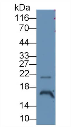 Western Blot: Angiogenin Antibody (C5) [NBP3-41553] - Sample: Hela cell lysate; Primary Ab: 3ug/ml NBP3-41553; Second Ab: 0.2ug/mL HRP-Linked Caprine Anti-Mouse IgG Polyclonal Antibody