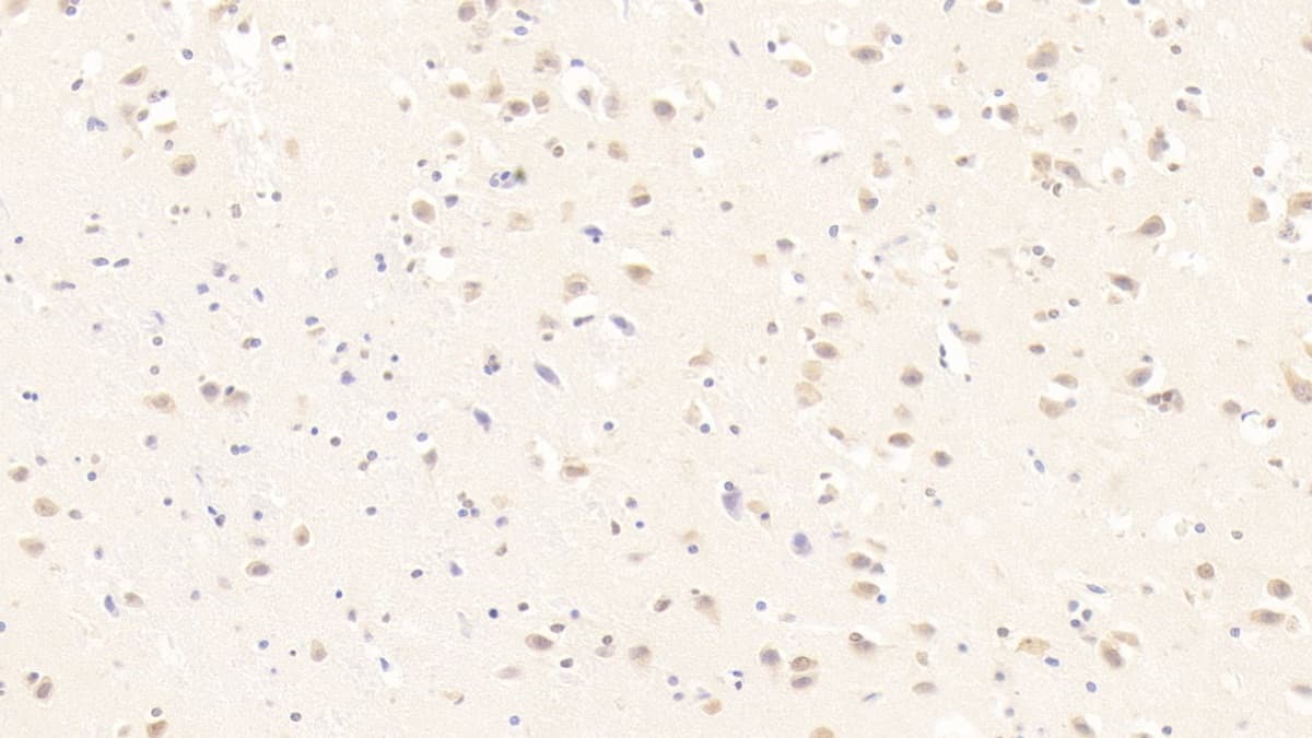 Immunohistochemistry-Paraffin: MOG Antibody (C2) [NBP3-41557] - DAB staining on IHC-P; Sample: Human Cerebrum Tissue; Primary Ab: 30ug/ml NBP3-41557; Second Ab: 2ug/mL HRP-Linked Caprine Anti-Mouse IgG Polyclonal Antibody