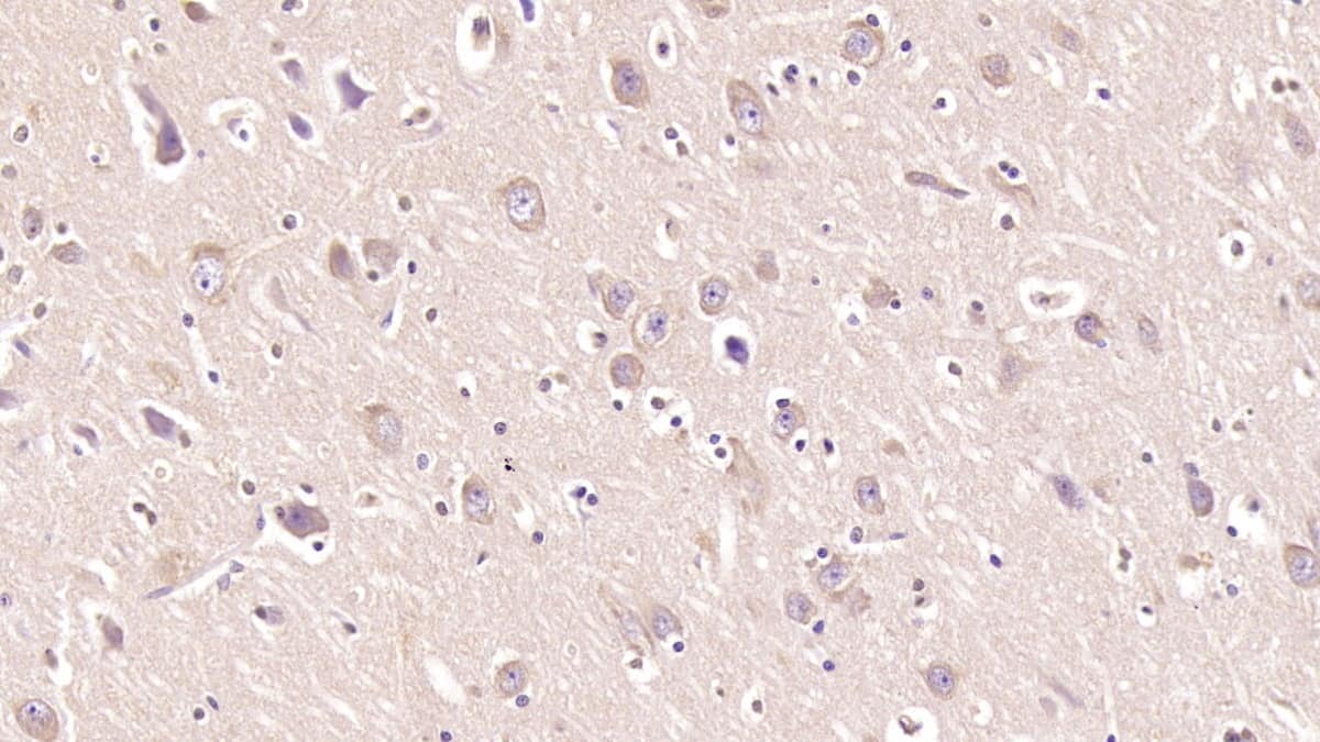 Immunohistochemistry-Paraffin: MOG Antibody (D2) [NBP3-41558] - DAB staining on IHC-P; Sample: Human Cerebrum Tissue; Primary Ab: 40ug/ml NBP3-41558; Second Ab: 2ug/mL HRP-Linked Caprine Anti-Mouse IgG Polyclonal Antibody