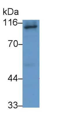Western Blot: ABP1/AOC1 Antibody (C12) [NBP3-41560] - 293T cell lysate Primary Ab: 3ug/ml NBP3-41560; Second Ab: 0.2ug/mL HRP-conjugated Goat Anti-Mouse IgG Polyclonal Antibody