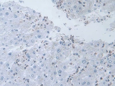 Immunohistochemistry-Paraffin: IL-19 Antibody (C9) [NBP3-41563] - DAB staining on IHC-P; Sample: Human Hepatic sinusoid Tissue; Primary Ab: 30ug/ml NBP3-41563; Second Ab: 2ug/mL HRP-Linked Caprine Anti-Mouse IgG Polyclonal Antibody