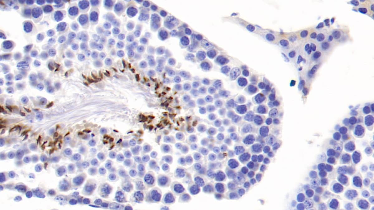 Immunohistochemistry-Paraffin: COMP/Thrombospondin-5 Antibody (C1) [NBP3-41565] - DAB staining on IHC-P; Samples: Mouse Testis Tissue; Primary Ab: 30ug/ml NBP3-41565; Second Ab: 2ug/mL HRP-Linked Caprine Anti-Mouse IgG Polyclonal Antibody