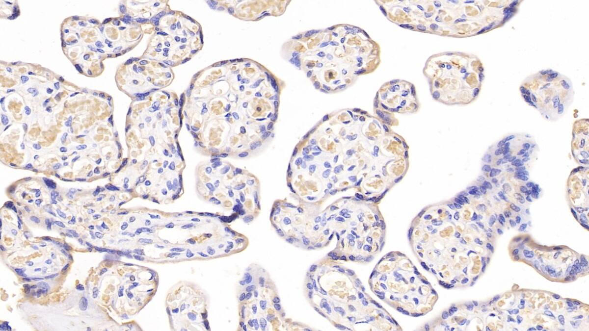 Immunohistochemistry-Paraffin: MBP-1 Antibody (C5) [NBP3-41566] - DAB staining on IHC-P; Samples: Human Placenta Tissue; Primary Ab: 20ug/ml NBP3-41566; Second Ab: 2ug/mL HRP-Linked Caprine Anti-Mouse IgG Polyclonal Antibody