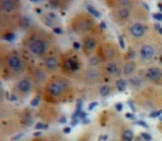 Immunohistochemistry-Paraffin HYAL2 Antibody