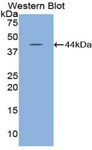 Western Blot HYAL2 Antibody