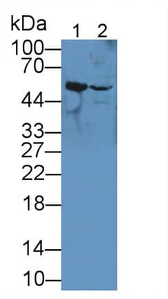 Western Blot TUBB6 Antibody