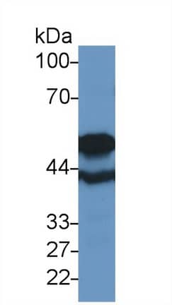 Western Blot TUBB6 Antibody