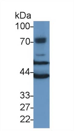 Western Blot TUBB6 Antibody