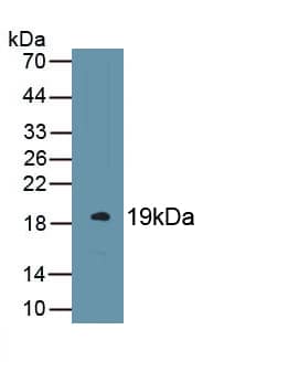 Western Blot: EPCR Antibody (C5) [NBP3-41569] - Sample: Recombinant PROCR, Rat.