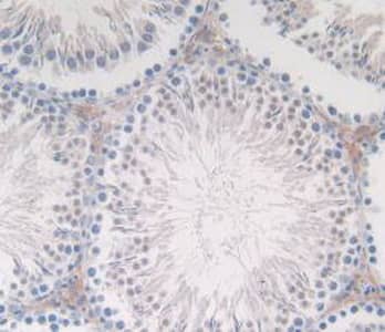 Immunohistochemistry-Paraffin: Calcitonin Antibody (C4) [NBP3-41571] - DAB staining on IHC-P; Samples: Rat Testis Tissue.