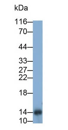 Western Blot: TFF2 Antibody (1-2#) [NBP3-41573] - Sample: Rat Pancreas lysate Primary Ab: 2ug/ml NBP3-41573; Second Ab: 0.2ug/mL HRP-Linked Caprine Anti-Mouse IgG Polyclonal Antibody