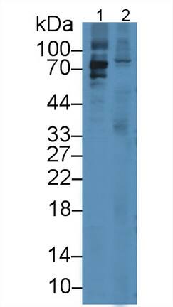 Western Blot: Lactoperoxidase Antibody (15#) [NBP3-41574] - Sample: Lane1: Rat Salivary gland lysate; Lane2: Rat Liver lysate Primary Ab: 3ug/ml NBP3-41574; Second Ab: 0.2ug/ml HRP-Linked Caprine Anti-Mouse IgG Polyclonal Antibody