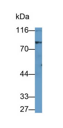 Western Blot: Hormone-sensitive Lipase/HSL Antibody (C1) [NBP3-41575] - Sample: Rat Cerebrum lysate Primary Ab: 0.5ug/ml NBP3-41575; Second Ab: 0.2ug/mL HRP-Linked Caprine Anti-Mouse IgG Polyclonal Antibody