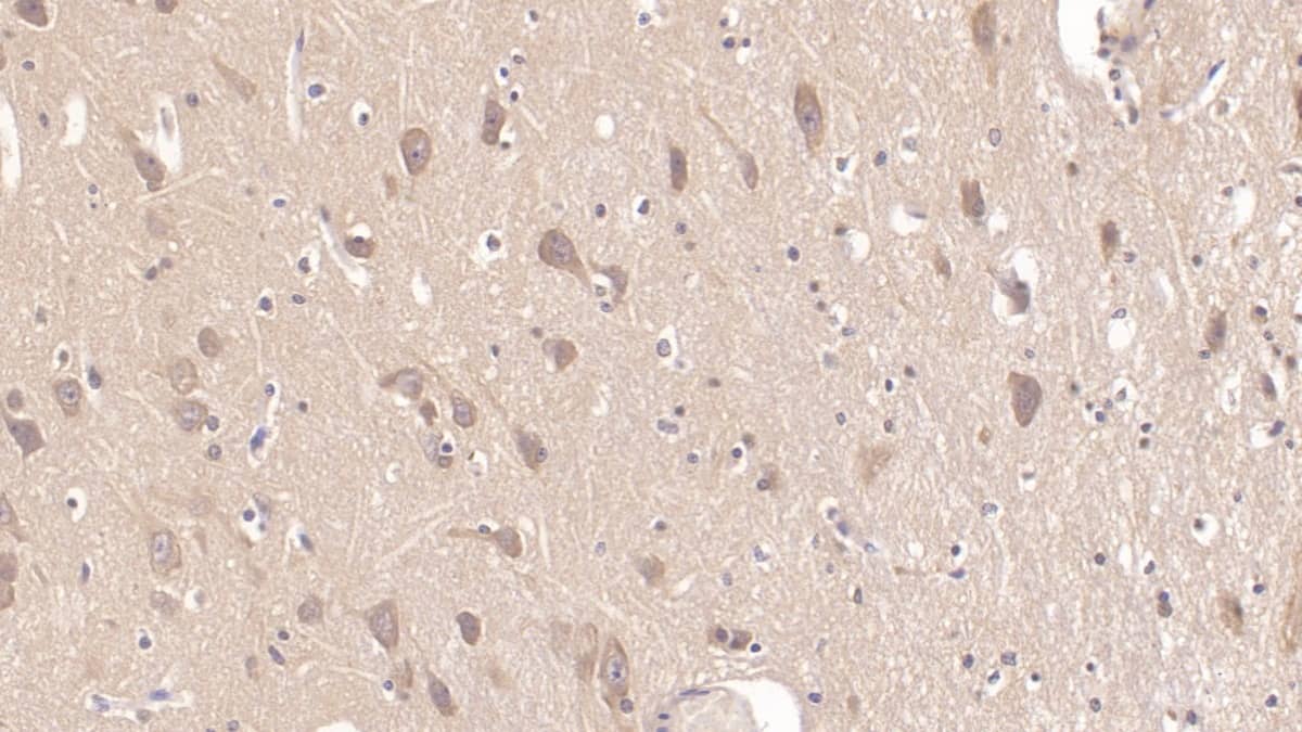 Immunohistochemistry-Paraffin: MMP-25/MT6-MMP Antibody (C7) [NBP3-41580] - DAB staining on IHC-P; Sample: Human Cerebrum Tissue; Primary Ab: 20ug/ml NBP3-41580; Second Ab: 2ug/mL HRP-Linked Caprine Anti-Mouse IgG Polyclonal Antibody