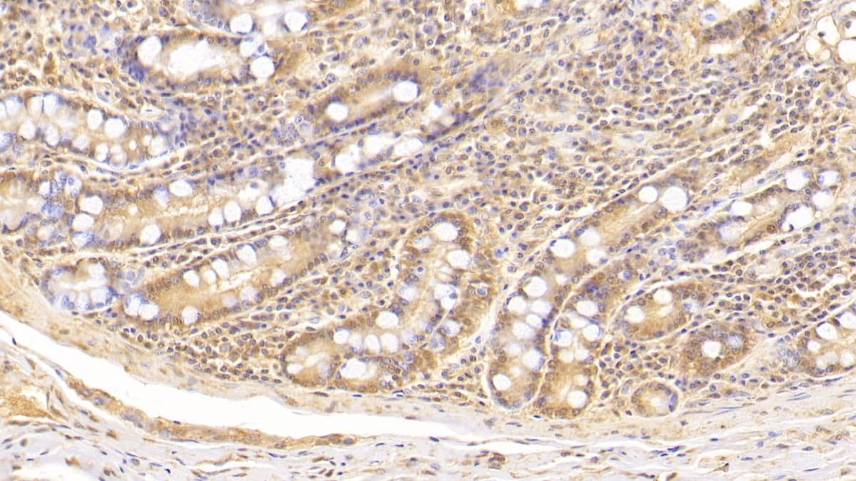 Immunohistochemistry-Paraffin: Complement Component C5a Antibody (D4) [NBP3-41581] - DAB staining on IHC-P; Sample: Human Small intestine Tissue; Primary Ab: 30ug/ml NBP3-41581; Second Ab: 2ug/mL HRP-Linked Caprine Anti-Mouse IgG Polyclonal Antibody