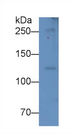 Western Blot: Complement Component C5a Antibody (D4) [NBP3-41581] - Sample: Rat Serum Primary Ab: 3ug/ml NBP3-41581; Second Ab: 0.2ug/mL HRP-Linked Caprine Anti-Mouse IgG Polyclonal Antibody